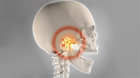 Çene disk kayması nedir?