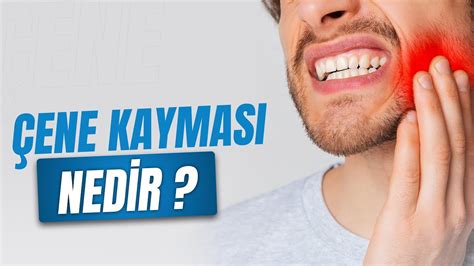 Çene Disk Kayması Tedavisi: İşaretler ve Uygulama Yöntemleri