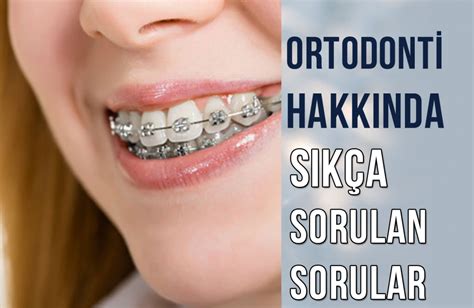 Çene Tedavisi: Sıkça Sorulan Sorular ve Cevaplar