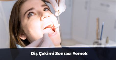 Diş çekimi sonrası ilk yemek deneyimi