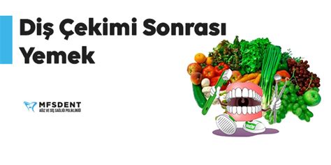 Diş Çekimi Sonrası Yemek: Hangi Gıdalar Tüketilmeli?