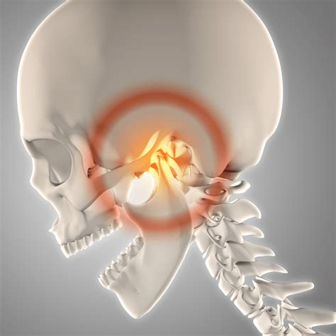 Temporomandibular Eklem Bozuklukları